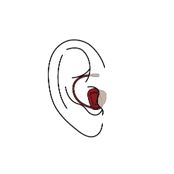 Remote hearing aid
